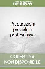 Preparazioni parziali in protesi fissa A Buon Prezzo