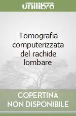 Tomografia computerizzata del rachide lombare Prezzo Conveniente