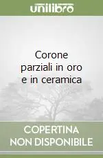 Corone parziali in oro e in ceramica Prezzo Di Fabbrica