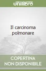 Il carcinoma polmonare Scelto Dai Clienti