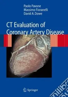 CT evaluation of coronary artery disease Popolare