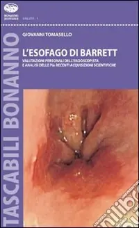 L‘Esofago di Barrett. Valutazioni personali dell‘endoscopista e analisi sulle più recenti acquisizioni scientifiche Professionale
