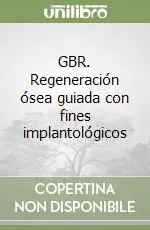 Prezzo Di Fabbrica GBR. Regeneración ósea guiada con fines implantológicos