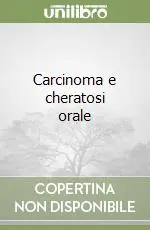 Carcinoma e cheratosi orale Scelto Dai Clienti