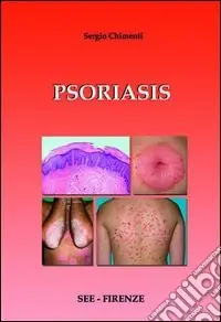 Compra Adesso Psoriasis